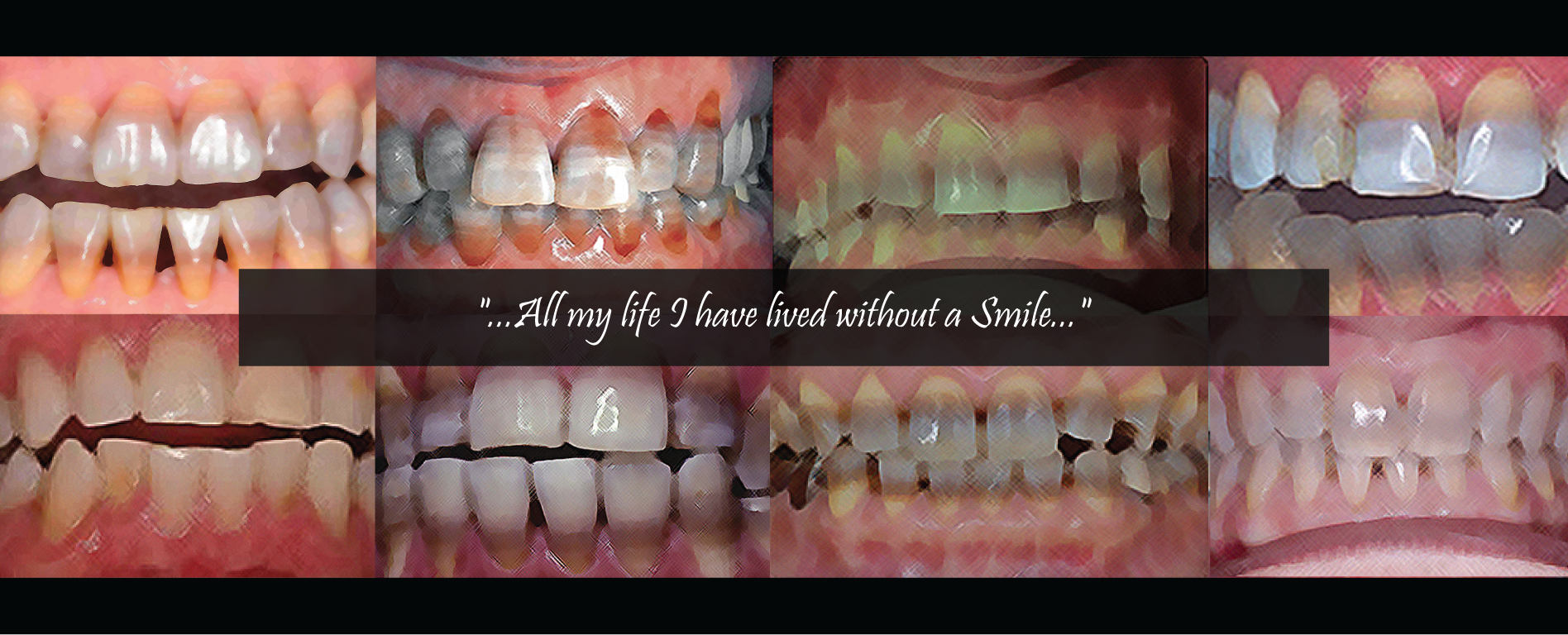 Tetracycline Teeth Staining, Our Impact, Affecting Change, banner with quote